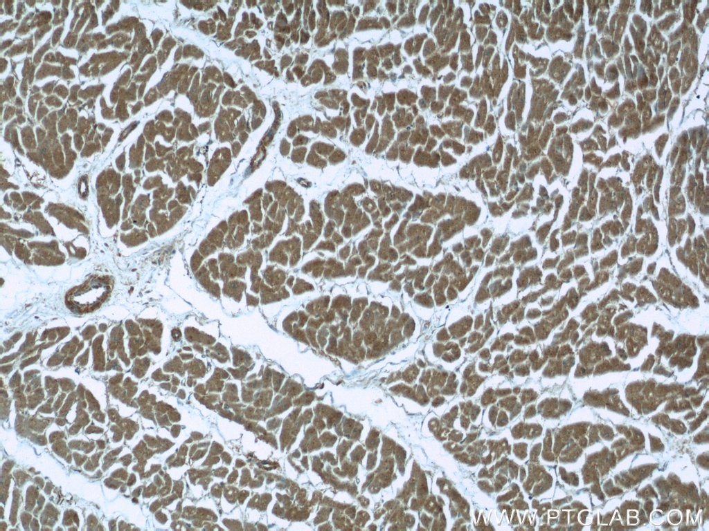 IHC staining of human heart using 13317-1-AP