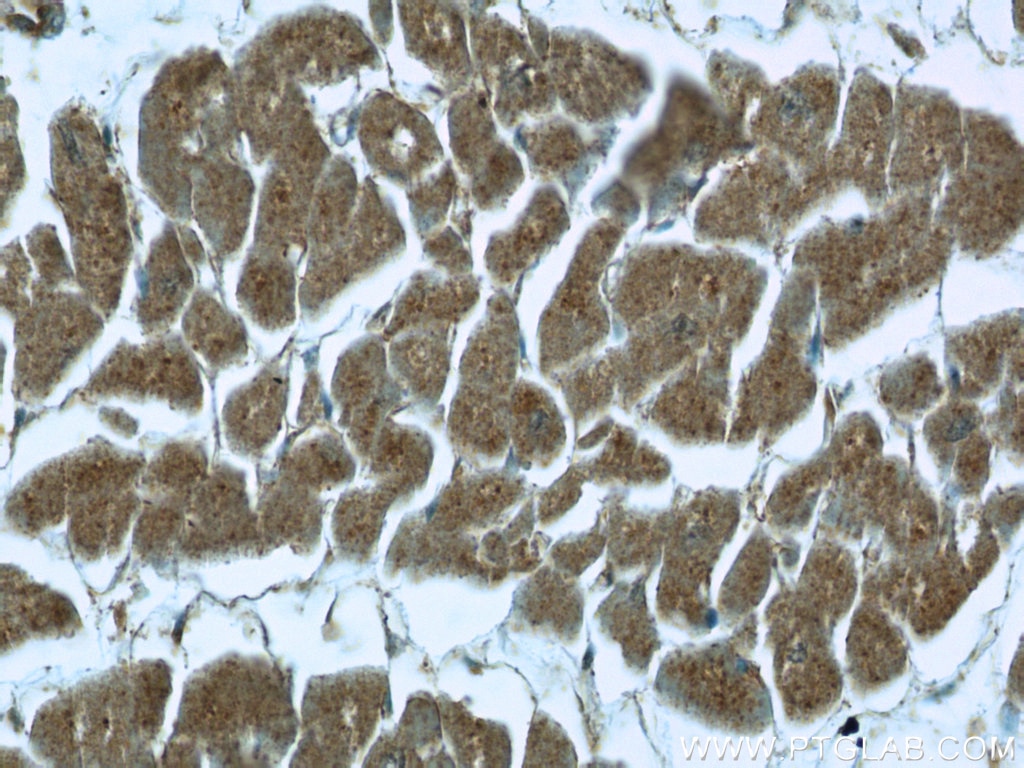Immunohistochemistry (IHC) staining of human heart tissue using Cytoglobin Polyclonal antibody (13317-1-AP)
