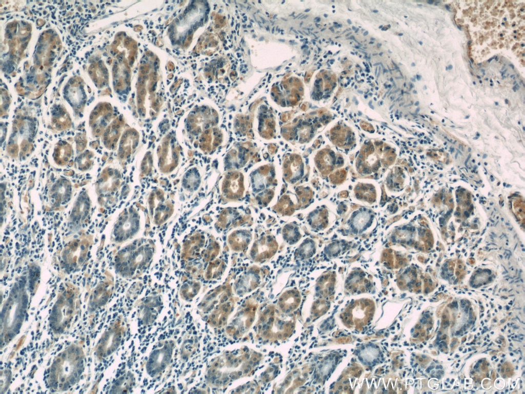 Immunohistochemistry (IHC) staining of human stomach tissue using Cytoglobin Polyclonal antibody (13317-1-AP)
