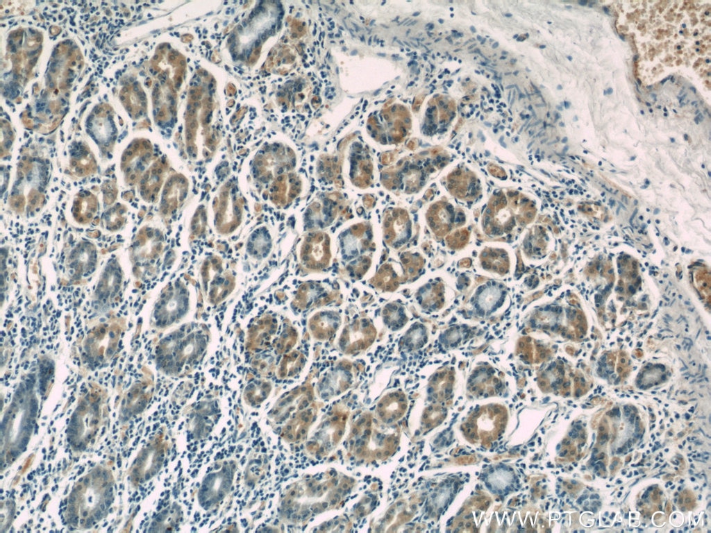 IHC staining of human stomach using 13317-1-AP