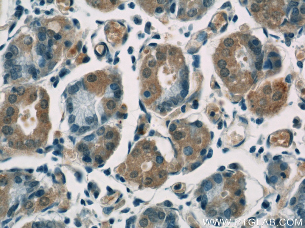 Immunohistochemistry (IHC) staining of human stomach tissue using Cytoglobin Polyclonal antibody (13317-1-AP)