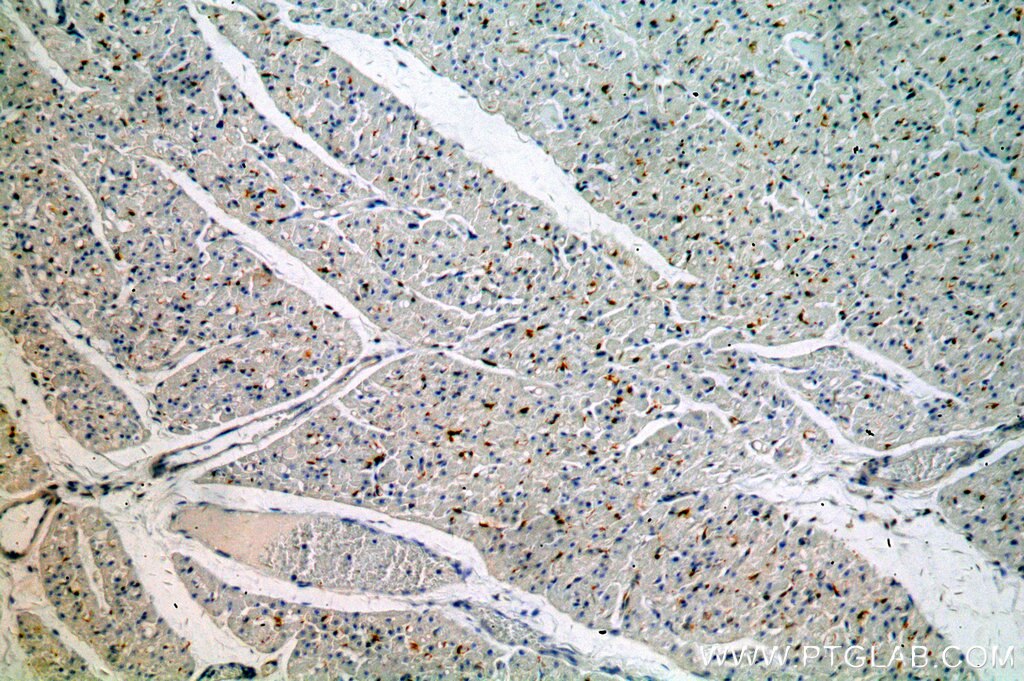 Cytoglobin