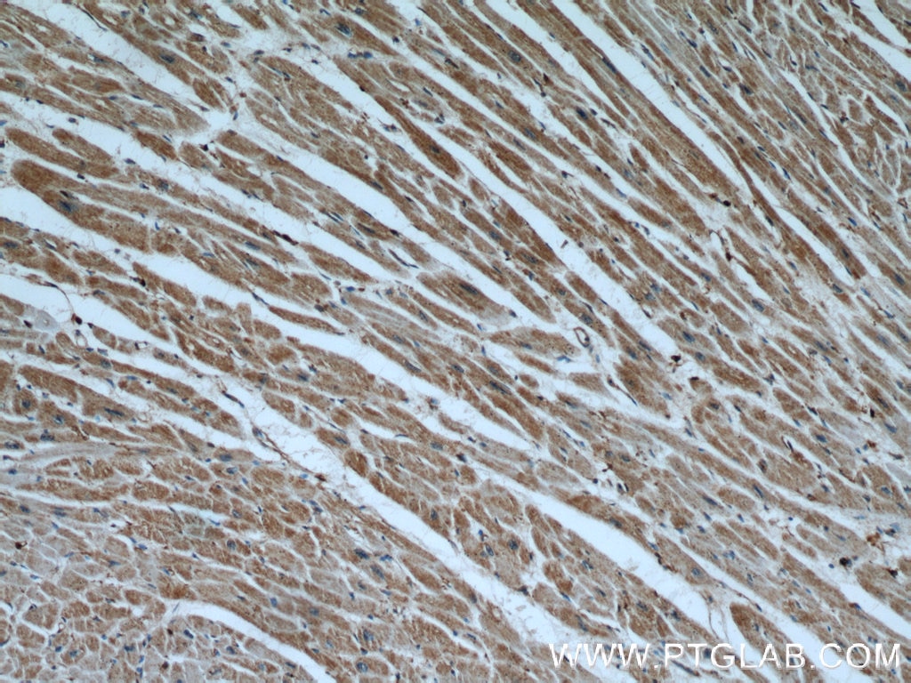 Immunohistochemistry (IHC) staining of human heart tissue using Cytoglobin Polyclonal antibody (13317-1-AP)