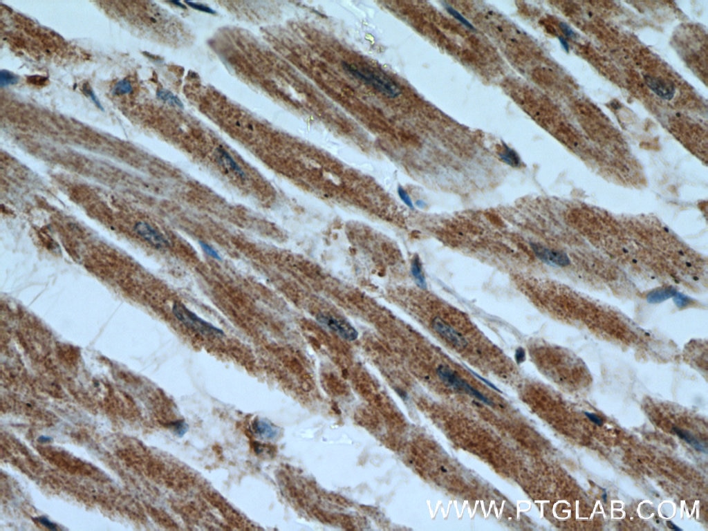 Immunohistochemistry (IHC) staining of human heart tissue using Cytoglobin Polyclonal antibody (13317-1-AP)