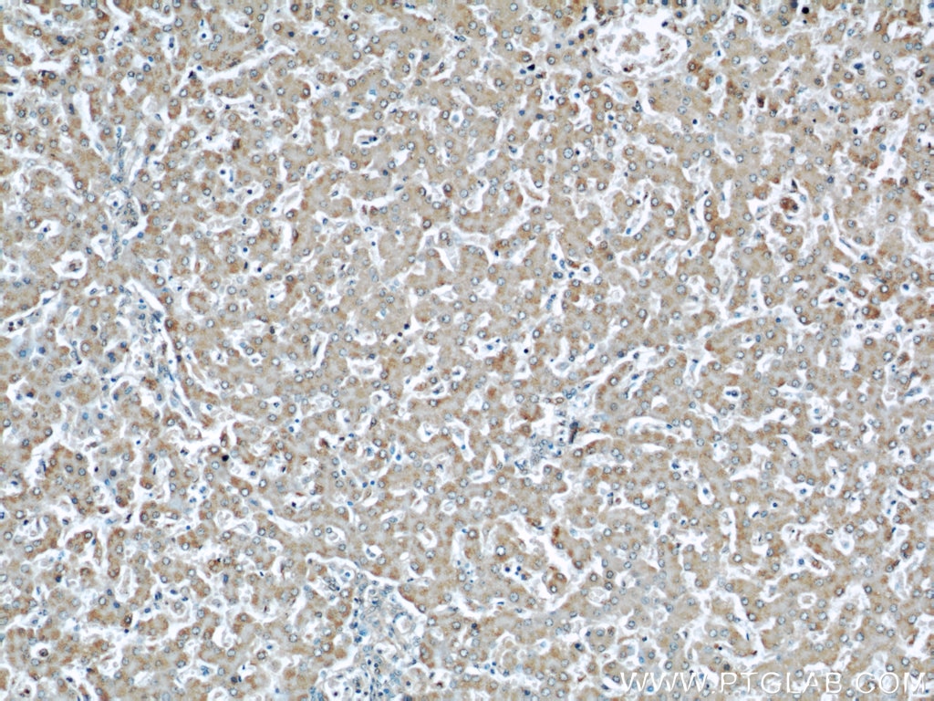 Immunohistochemistry (IHC) staining of human liver tissue using Cytoglobin Polyclonal antibody (13317-1-AP)