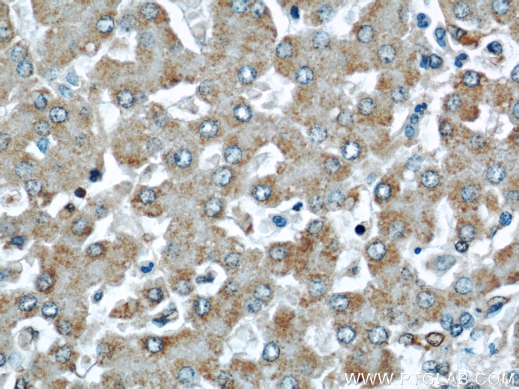 Immunohistochemistry (IHC) staining of human liver tissue using Cytoglobin Polyclonal antibody (13317-1-AP)