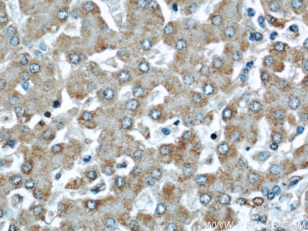 IHC staining of human liver using 13317-1-AP