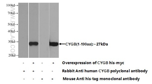 Western Blot (WB) analysis of Transfected HEK-293 cells using Cytoglobin Polyclonal antibody (13317-1-AP)