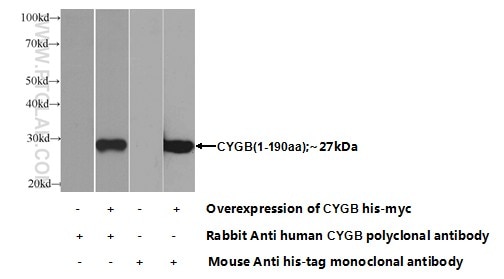 WB analysis of Transfected HEK-293 using 13317-1-AP