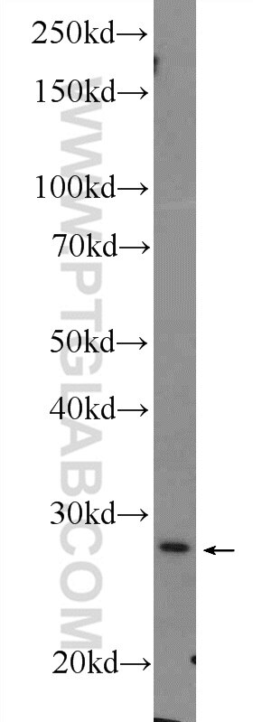 Western Blot (WB) analysis of mouse stomach tissue using Cytoglobin Polyclonal antibody (13317-1-AP)