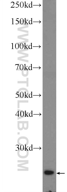 Western Blot (WB) analysis of mouse small intestine tissue using Cytoglobin Polyclonal antibody (13317-1-AP)