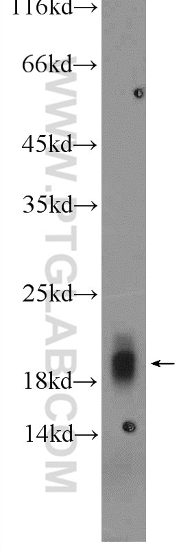Western Blot (WB) analysis of rat kidney tissue using Cytoglobin Polyclonal antibody (13317-1-AP)