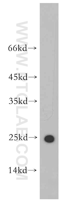 Western Blot (WB) analysis of human uterus tissue using Cytoglobin Polyclonal antibody (13317-1-AP)