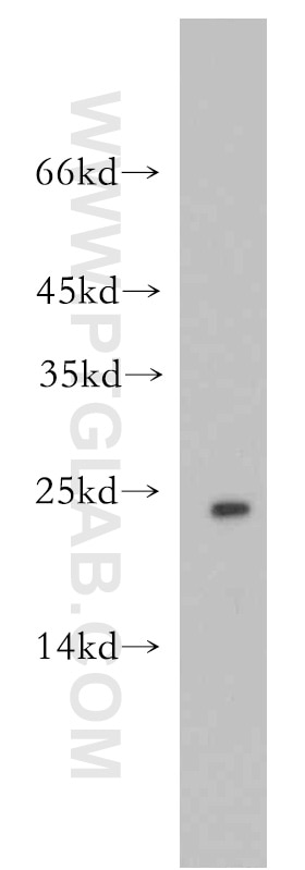 Western Blot (WB) analysis of human heart tissue using Cytoglobin Polyclonal antibody (13317-1-AP)