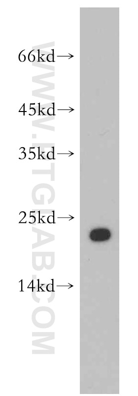 Western Blot (WB) analysis of mouse brain tissue using Cytoglobin Polyclonal antibody (13317-1-AP)