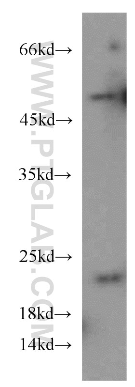 Western Blot (WB) analysis of mouse kidney tissue using Cytoglobin Polyclonal antibody (13317-1-AP)