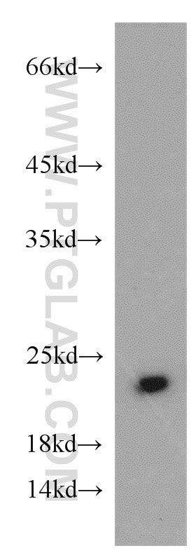 Western Blot (WB) analysis of mouse spleen tissue using Cytoglobin Polyclonal antibody (13317-1-AP)