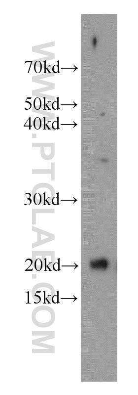 Western Blot (WB) analysis of mouse brain tissue using Cytoglobin Polyclonal antibody (13317-1-AP)