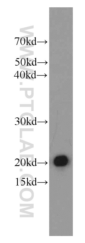 WB analysis of mouse heart using 13317-1-AP