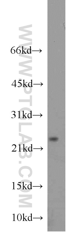 Western Blot (WB) analysis of mouse lung tissue using Cytoglobin Polyclonal antibody (13317-1-AP)