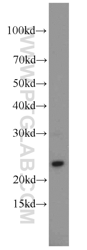 Western Blot (WB) analysis of mouse small intestine tissue using Cytoglobin Polyclonal antibody (13317-1-AP)