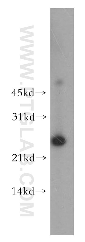 Western Blot (WB) analysis of PC-3 cells using Cytoglobin Polyclonal antibody (13317-1-AP)