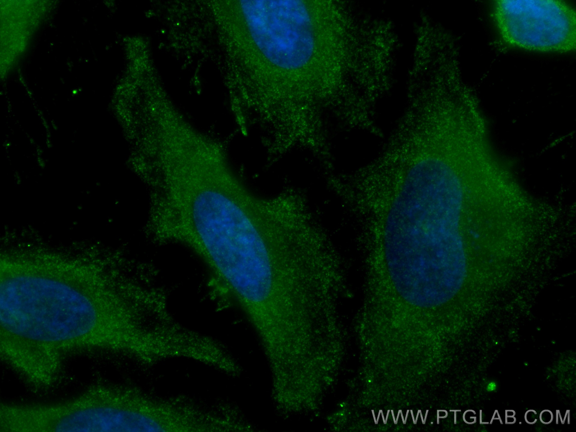 Cytoglobin