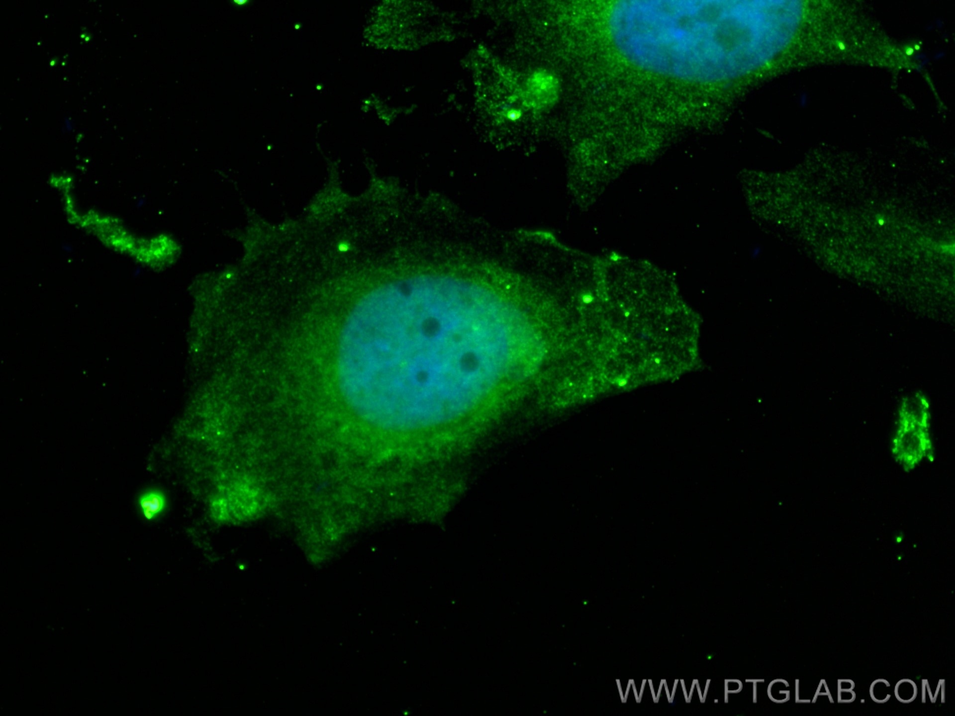 Immunofluorescence (IF) / fluorescent staining of HeLa cells using Cytoglobin Monoclonal antibody (60228-1-Ig)