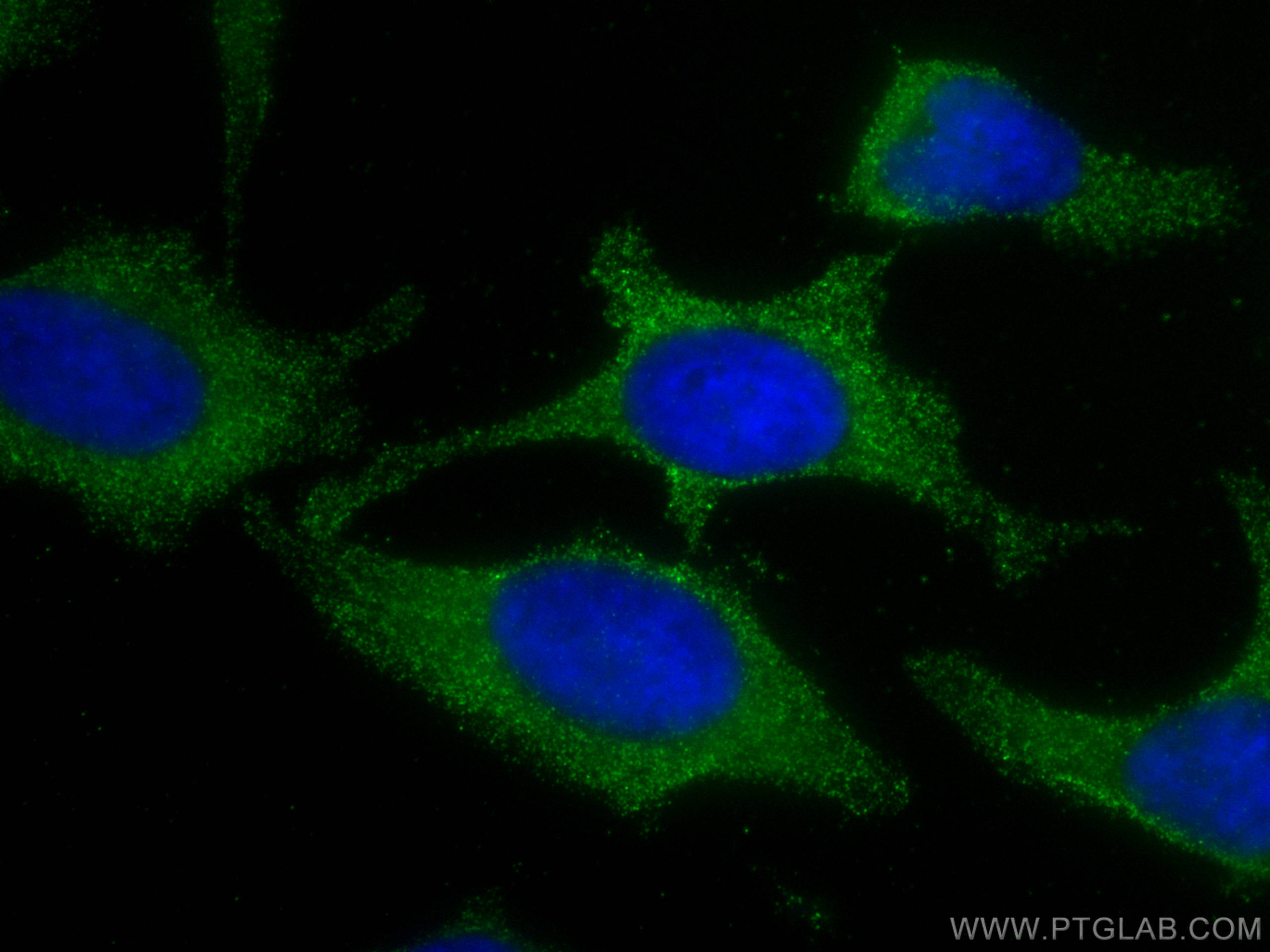 Immunofluorescence (IF) / fluorescent staining of HeLa cells using Cytoglobin Monoclonal antibody (60228-1-Ig)