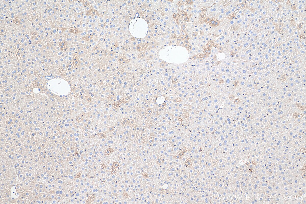 Cytoglobin