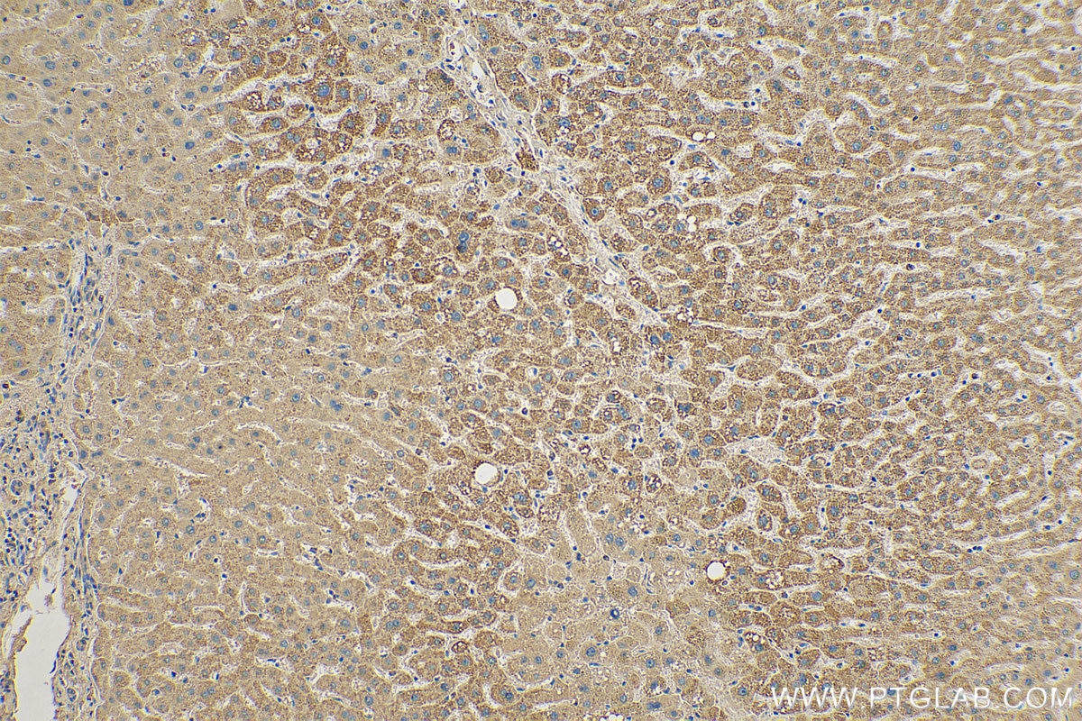 Immunohistochemistry (IHC) staining of human liver tissue using Cytoglobin Monoclonal antibody (60228-1-Ig)