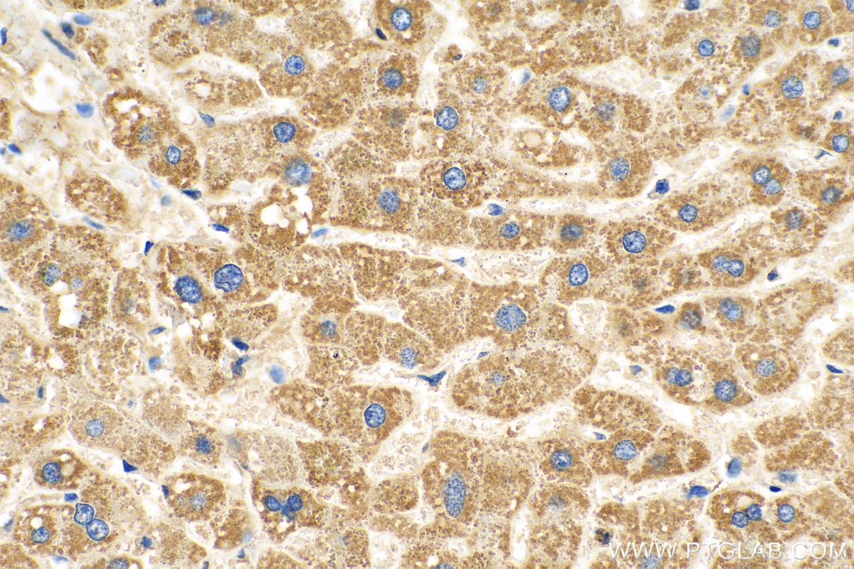 Immunohistochemistry (IHC) staining of human liver tissue using Cytoglobin Monoclonal antibody (60228-1-Ig)