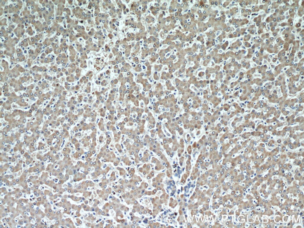 Immunohistochemistry (IHC) staining of human liver tissue using Cytoglobin Monoclonal antibody (60228-1-Ig)