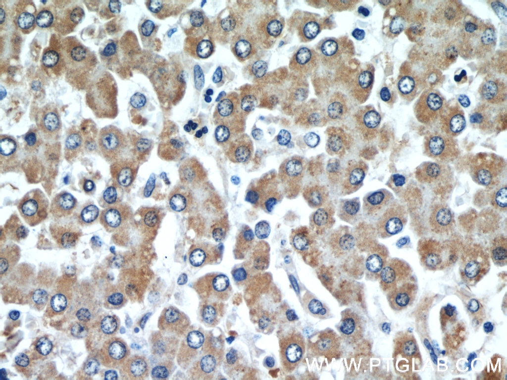 Immunohistochemistry (IHC) staining of human liver tissue using Cytoglobin Monoclonal antibody (60228-1-Ig)