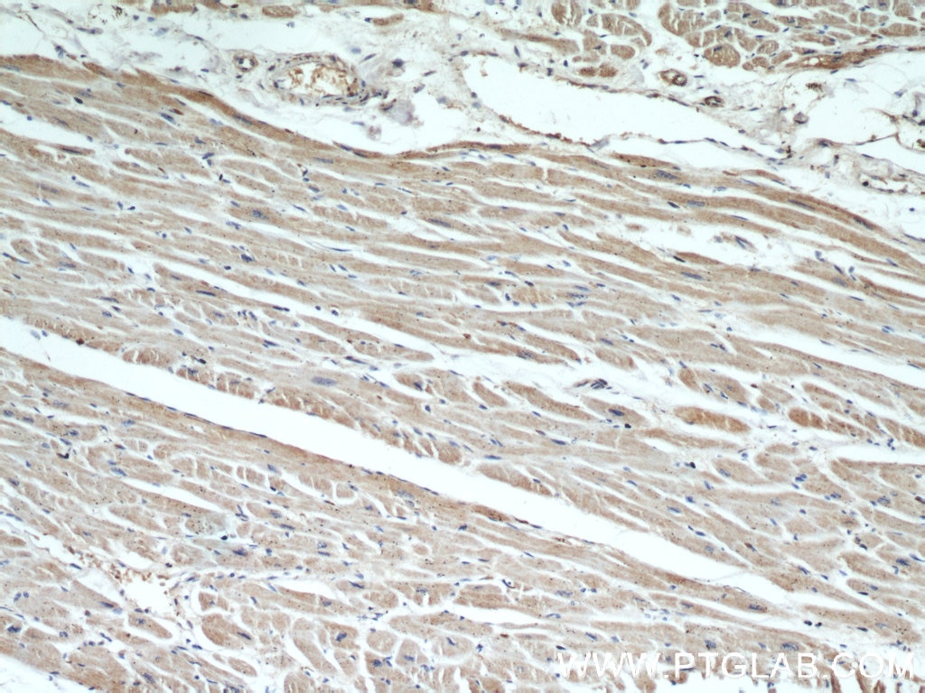 IHC staining of human heart using 60228-1-Ig