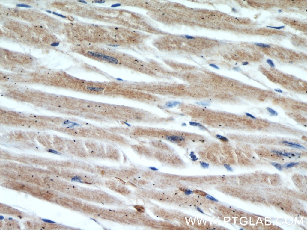 IHC staining of human heart using 60228-1-Ig