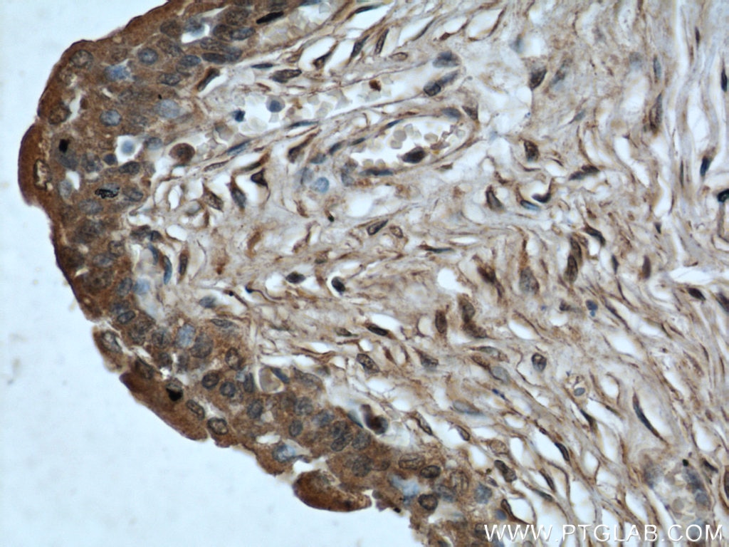 Immunohistochemistry (IHC) staining of human bladder tissue using Cytoglobin Monoclonal antibody (60228-1-Ig)