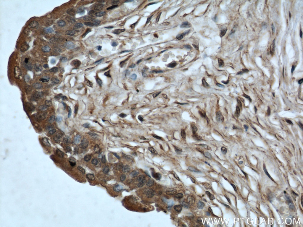 IHC staining of human bladder using 60228-1-Ig