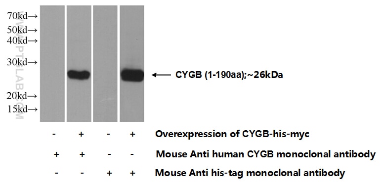 Western Blot (WB) analysis of Transfected HEK-293 cells using Cytoglobin Monoclonal antibody (60228-1-Ig)