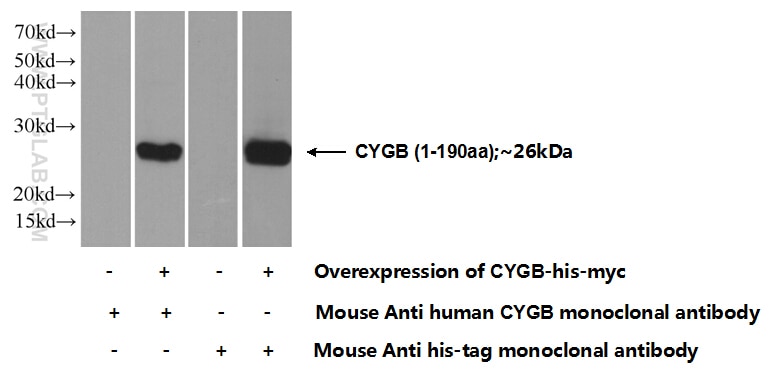 WB analysis of Transfected HEK-293 using 60228-1-Ig