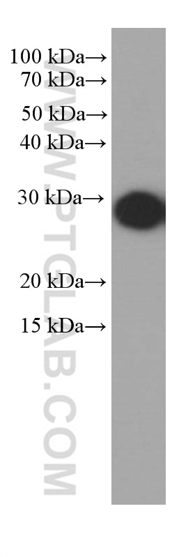 Western Blot (WB) analysis of pig heart tissue using Cytoglobin Monoclonal antibody (60228-1-Ig)