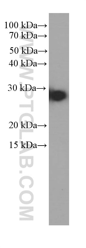 Western Blot (WB) analysis of pig heart tissue using Cytoglobin Monoclonal antibody (60228-1-Ig)