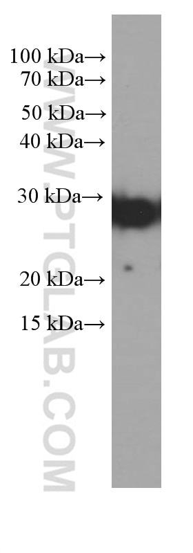 Western Blot (WB) analysis of rat heart tissue using Cytoglobin Monoclonal antibody (60228-1-Ig)