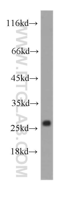 Western Blot (WB) analysis of human heart tissue using Cytoglobin Monoclonal antibody (60228-1-Ig)