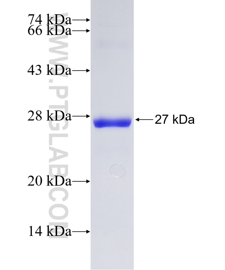 CYGB fusion protein Ag4161 SDS-PAGE