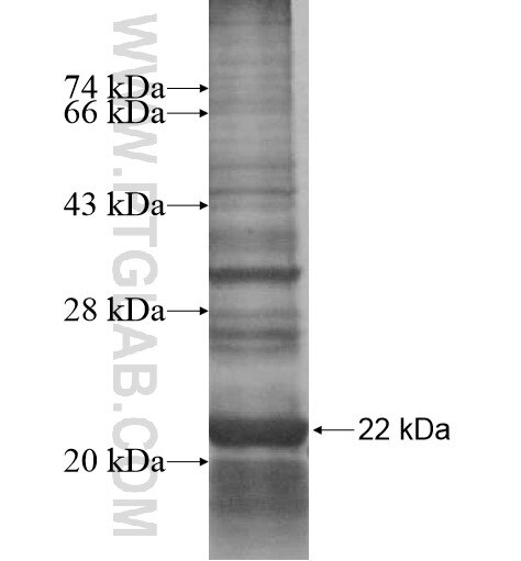 CYHR1 fusion protein Ag15220 SDS-PAGE