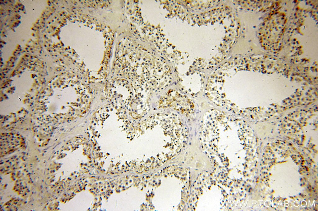 Immunohistochemistry (IHC) staining of human testis tissue using CYLC2 Polyclonal antibody (18729-1-AP)