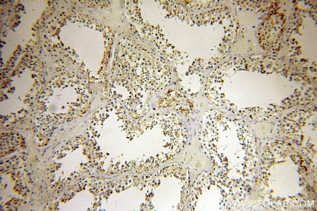 IHC staining of human testis using 18729-1-AP