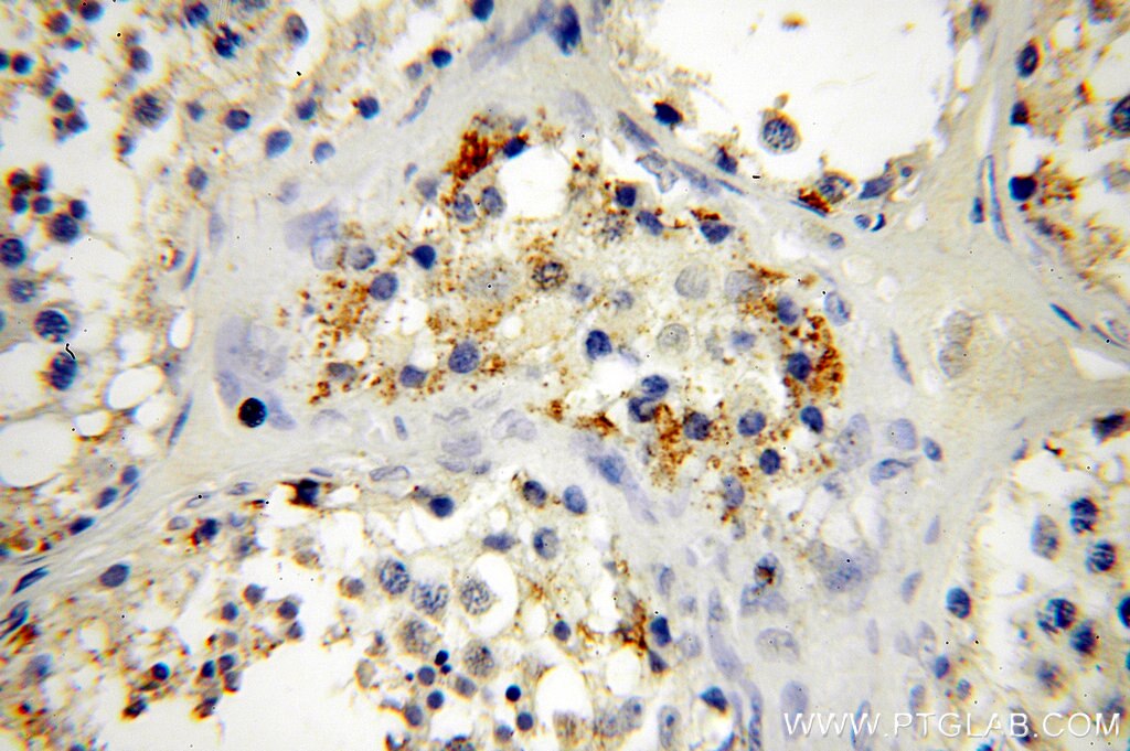 Immunohistochemistry (IHC) staining of human testis tissue using CYLC2 Polyclonal antibody (18729-1-AP)