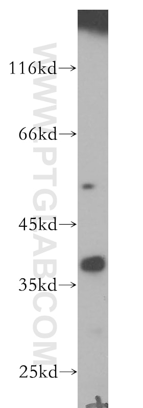 Western Blot (WB) analysis of human adrenal gland tissue using CYLC2 Polyclonal antibody (18729-1-AP)